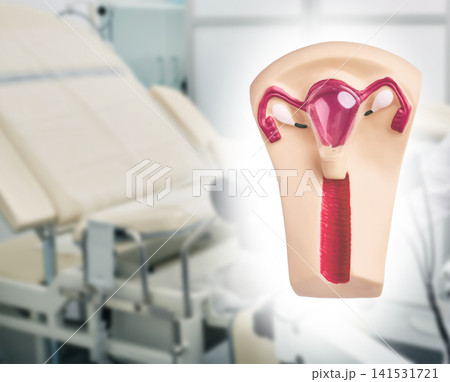 Uterus anatomical model on background of gynecological chair in clinic. Gynecology diagnostics and female reproductive health exam. Uterus anatomical model on background of gynecological chair in clinic. Gynecology diagnostics and female reproductive health exam. 141531721
