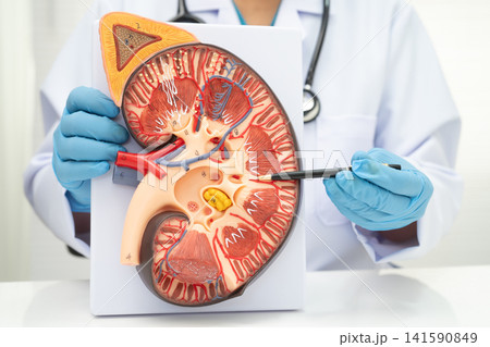 Kidney disease, Chronic kidney disease ckd, Doctor hold human model to treat and study in hospital. Kidney disease, Chronic kidney disease ckd, Doctor hold human model to treat and study in hospital. 141590849