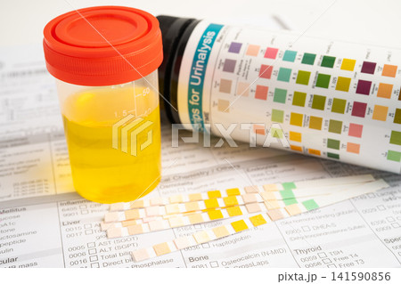 Urinalysis, urine cup with reagent strip pH paper test and comparison chart in laboratory. 141590856