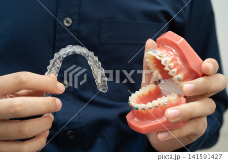Man holding invisible aligner orthodontic retainer for dental teeth straightening. Man holding invisible aligner orthodontic retainer for dental teeth straightening. 141591427