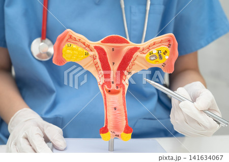 Doctor holding human uterus model for vaginal and cervix pap smear check up in the obstetrics and gynecology. 141634067
