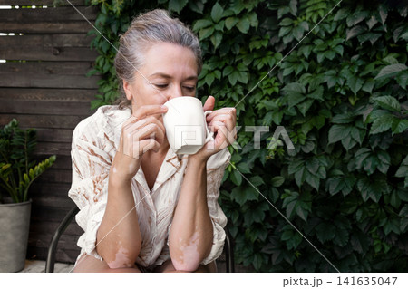 Mature woman with vitiligo skin and gray hair. Female with autoimmune disease. pigmentation. scene radiates tranquility, self love, and body positivity, capturing the essence of embracing Mature woman with vitiligo skin and gray hair. Female with autoimmune disease. pigmentation. scene radiates tranquility, self love, and body positivity, capturing the essence of embracing 141635047