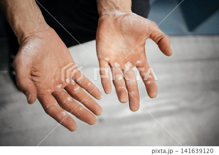 Chalk Covered Male Climber Hands After Hard Route: Close Up Of Worn Fingers And Taped Skin Chalk Covered Male Climber Hands After Hard Route: Close Up Of Worn Fingers And Taped Skin 141639120