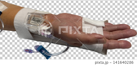 導尿管治療後的手，有止血帶和靜脈輸液管（透明背景 PNG） 141640286
