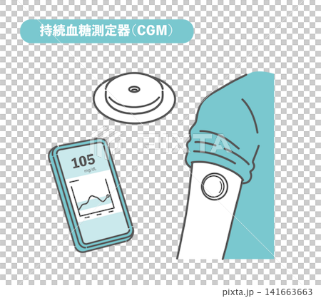 連續血糖監測儀(CGM)插圖集 連續血糖監測儀(CGM)插圖集 141663663