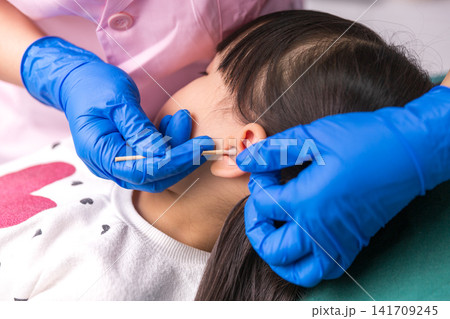 Professional pediatric ear cleaning. Pediatrician hands in blue gloves cleaning a little girl's ear with a cotton swab. Professional pediatric ear cleaning. Pediatrician hands in blue gloves cleaning a little girl's ear with a cotton swab. 141709245
