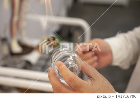 Close-up of a practitioner holding a clear glass jar and a burning cotton swab Close-up of a practitioner holding a clear glass jar and a burning cotton swab 141716706