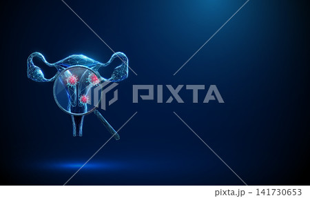 3D blue uterus and magnifying glass with viruses inside. Gynecology, viral infection, HPV diagnosis, women health, sexual disease, pathogen virus detection concept 3D blue uterus and magnifying glass with viruses inside. Gynecology, viral infection, HPV diagnosis, women health, sexual disease, pathogen virus detection concept 141730653