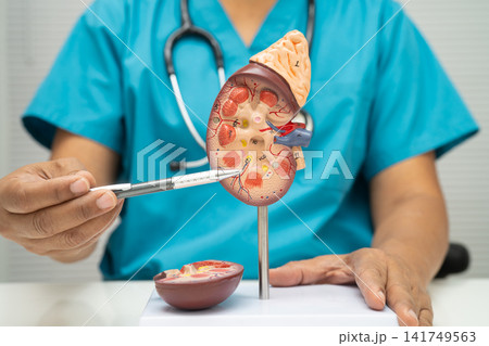 Chronic kidney disease, doctor with model for treatment urinary system, urology, Estimated glomerular filtration rate eGFR. 141749563