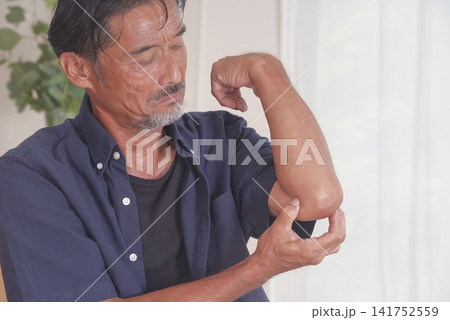 肘の痛みに顔をしかめる中高年男性 肘の痛みに顔をしかめる中高年男性 141752559