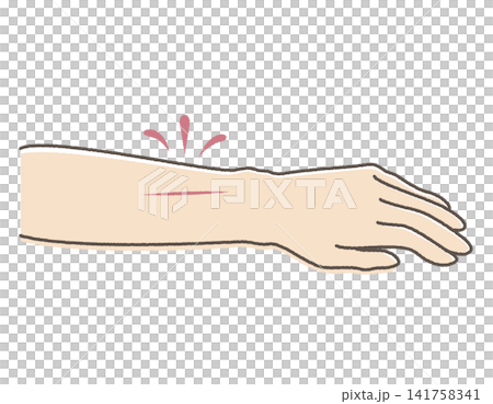 怪我をして出血している腕のイメージ図(手描き風線) 怪我をして出血している腕のイメージ図(手描き風線) 141758341