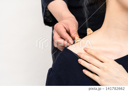 首の付け根に二つの円錐形もぐさを置く女性 首の付け根に二つの円錐形もぐさを置く女性 141782662