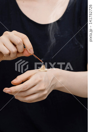 女性の手の甲のにんにく灸と立ち上る煙 141782726