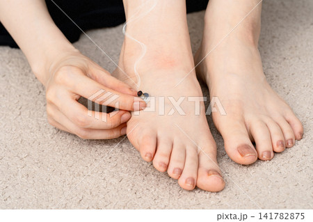 足の甲の台座灸を指先で整える女性の両足 141782875