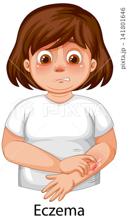 Cartoon Illustration of a Young Girl Scratching an Eczema Rash Cartoon Illustration of a Young Girl Scratching an Eczema Rash 141801646