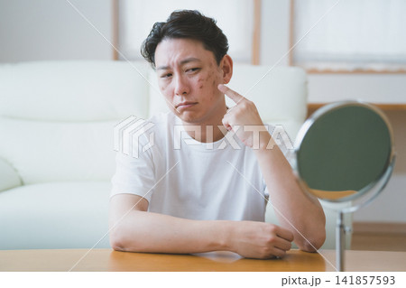 卓上鏡の前で指で頬のシミを指差し悩む40代男性のシミケア 卓上鏡の前で指で頬のシミを指差し悩む40代男性のシミケア 141857593