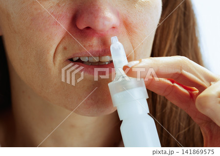 Managing Nasal Congestion with Skin Irritation Managing Nasal Congestion with Skin Irritation 141869575