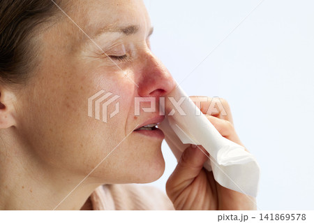Woman with Allergy Symptoms and Red Nose 141869578