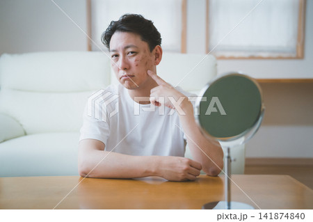 指でシミを指差しカメラ目線で困り顔の40代男性のシミチェック 指でシミを指差しカメラ目線で困り顔の40代男性のシミチェック 141874840