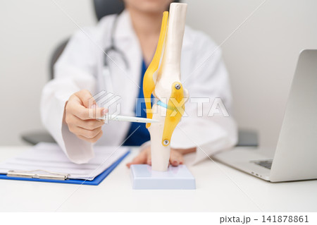 Doctor with Human Knee joint anatomy model. Osteoarthritis, Patellofemoral Pain Syndrome, Patellar Tendinitis, ACL, Anterior Cruciate Ligament, PCL, Posterior, MCL, Medial Collateral, LCL and Lateral Doctor with Human Knee joint anatomy model. Osteoarthritis, Patellofemoral Pain Syndrome, Patellar Tendinitis, ACL, Anterior Cruciate Ligament, PCL, Posterior, MCL, Medial Collateral, LCL and Lateral 141878861