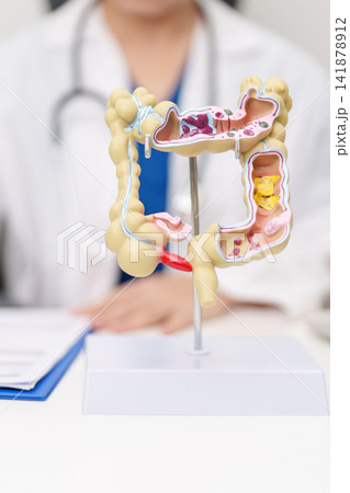 Doctor with human Colon anatomy model. Colonic disease, Large Intestine, Colorectal cancer, Ulcerative colitis, Diverticulitis, Irritable bowel syndrome, Digestive system and Healthcare concept Doctor with human Colon anatomy model. Colonic disease, Large Intestine, Colorectal cancer, Ulcerative colitis, Diverticulitis, Irritable bowel syndrome, Digestive system and Healthcare concept 141878912
