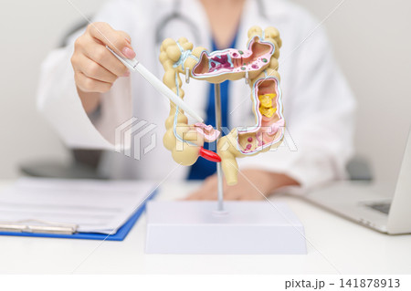 Doctor with human Colon anatomy model. Colonic disease, Large Intestine, Colorectal cancer, Ulcerative colitis, Diverticulitis, Irritable bowel syndrome, Digestive system and Healthcare concept Doctor with human Colon anatomy model. Colonic disease, Large Intestine, Colorectal cancer, Ulcerative colitis, Diverticulitis, Irritable bowel syndrome, Digestive system and Healthcare concept 141878913