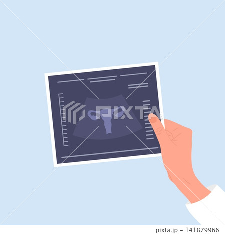 Uterus health. Female hand holding ultrasound result. Medical diagnosis and treatment for uterine diseases, cancer or endometriosis. Vector illustration in flat style 141879966