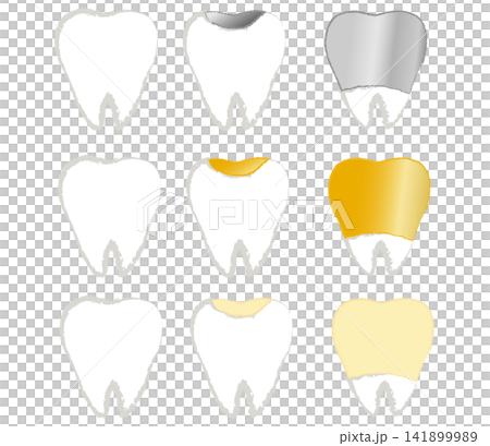 Illustrations of dental crowns: silver, gold, and ceramic. Illustrations of dental crowns: silver, gold, and ceramic. 141899989