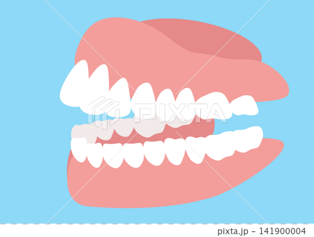 Illustration of a sideways denture (complete denture) Illustration of a sideways denture (complete denture) 141900004