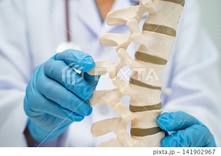 Doctor holding osteoporosis in back bone model. Doctor holding osteoporosis in back bone model. 141902967
