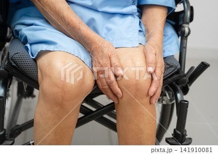 Asian elderly woman patient with scar knee replacement surgery in hospital. Asian elderly woman patient with scar knee replacement surgery in hospital. 141910081