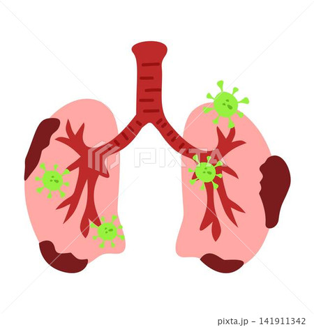 pneumonia illustration medical disease bronchitis pneumonia illustration medical disease bronchitis 141911342
