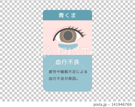 目のクマの種類イラスト(青クマ)血行不良と説明文 目のクマの種類イラスト(青クマ)血行不良と説明文 141946769