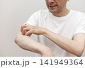 腕の激しい痒みで皮膚を掻きむしるミドル男性 痒い 痒み 腕の激しい痒みで皮膚を掻きむしるミドル男性 痒い 痒み 141949364