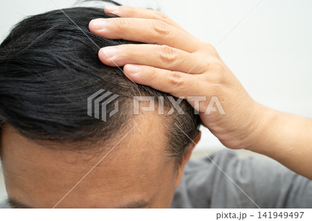 Bald in the middle head and begin no loss hair glabrous of mature Asian business smart active office man. Bald in the middle head and begin no loss hair glabrous of mature Asian business smart active office man. 141949497