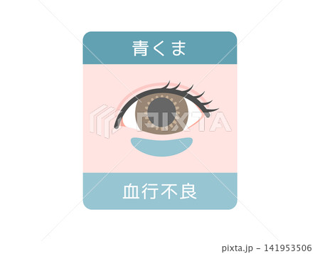 目のクマの種類イラスト(青クマ)血行不良 目のクマの種類イラスト(青クマ)血行不良 141953506