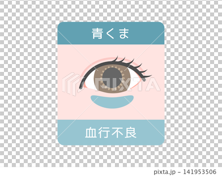 目のクマの種類イラスト(青クマ)血行不良 目のクマの種類イラスト(青クマ)血行不良 141953506