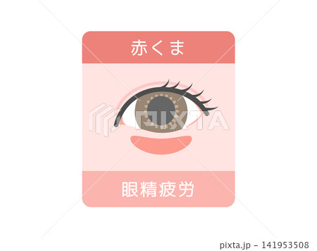 目のクマの種類イラスト（赤クマ）眼精疲労 141953508