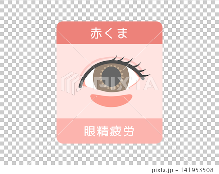 目のクマの種類イラスト（赤クマ）眼精疲労 141953508