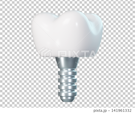 implant, tooth, dental 141961332
