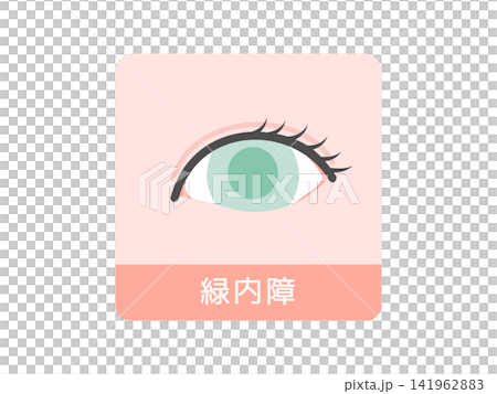 緑内障 目 イラスト 緑内障 目 イラスト 141962883
