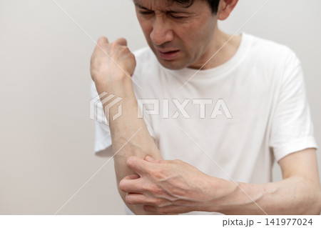 腕の激しい痒みで皮膚を掻きむしるミドル男性 痒い 痒み 腕の激しい痒みで皮膚を掻きむしるミドル男性 痒い 痒み 141977024