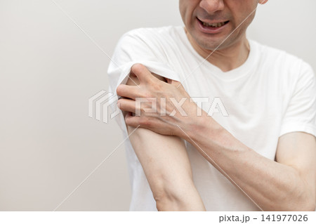 腕の激しい痒みで皮膚を掻きむしるミドル男性　痒い　痒み 141977026