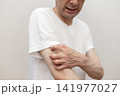 腕の激しい痒みで皮膚を掻きむしるミドル男性 痒い 痒み 腕の激しい痒みで皮膚を掻きむしるミドル男性 痒い 痒み 141977027