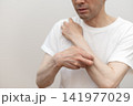 腕の激しい痒みで皮膚を掻きむしるミドル男性 痒い 痒み 腕の激しい痒みで皮膚を掻きむしるミドル男性 痒い 痒み 141977029