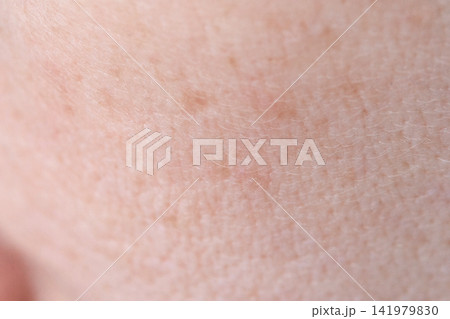 Facial Skin Showing Fine Pores Dry Texture And Slight Redness On Cheek Closeup In Neutral Indoor Facial Skin Showing Fine Pores Dry Texture And Slight Redness On Cheek Closeup In Neutral Indoor 141979830