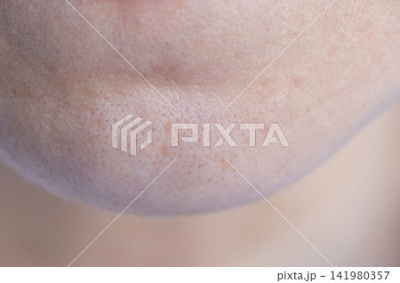 Chin Area Displaying Visible Pores And Slight Hyperpigmentation In Close Up Studio Setting Chin Area Displaying Visible Pores And Slight Hyperpigmentation In Close Up Studio Setting 141980357