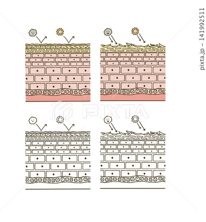 ビューティー 肌のダメージについての肌断面図のイラストレーション ビューティー 肌のダメージについての肌断面図のイラストレーション 141992511