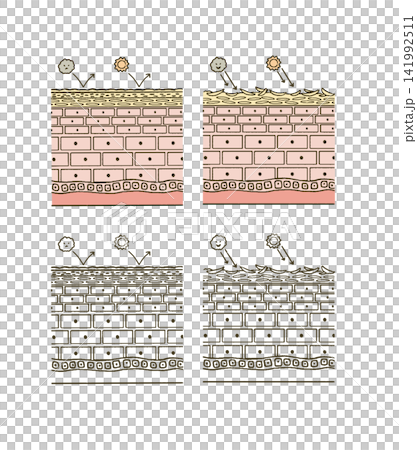 ビューティー 肌のダメージについての肌断面図のイラストレーション ビューティー 肌のダメージについての肌断面図のイラストレーション 141992511