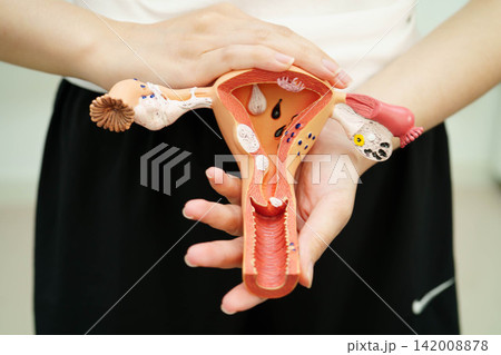 Uterus, Asian woman holding human anatomy model. Uterus, Asian woman holding human anatomy model. 142008878
